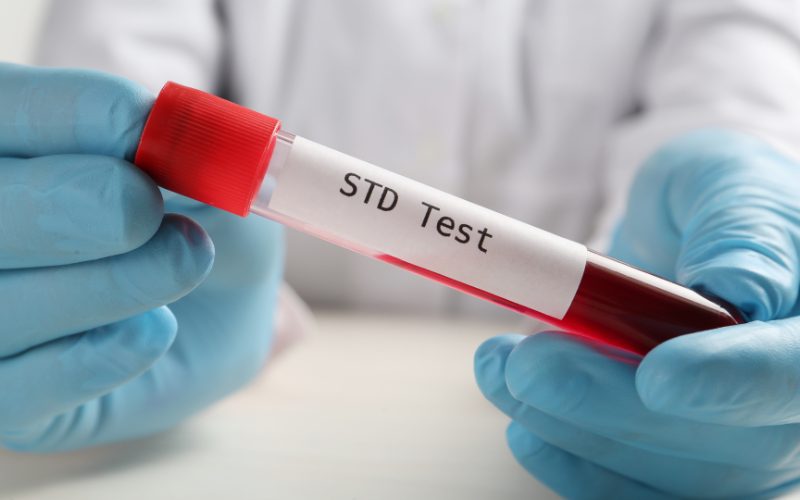 std-treatment-2